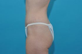 fit-mom-after-side