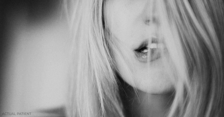 Benefits of Customized Lip Injections | Austin Cosmetic Surgery Practice