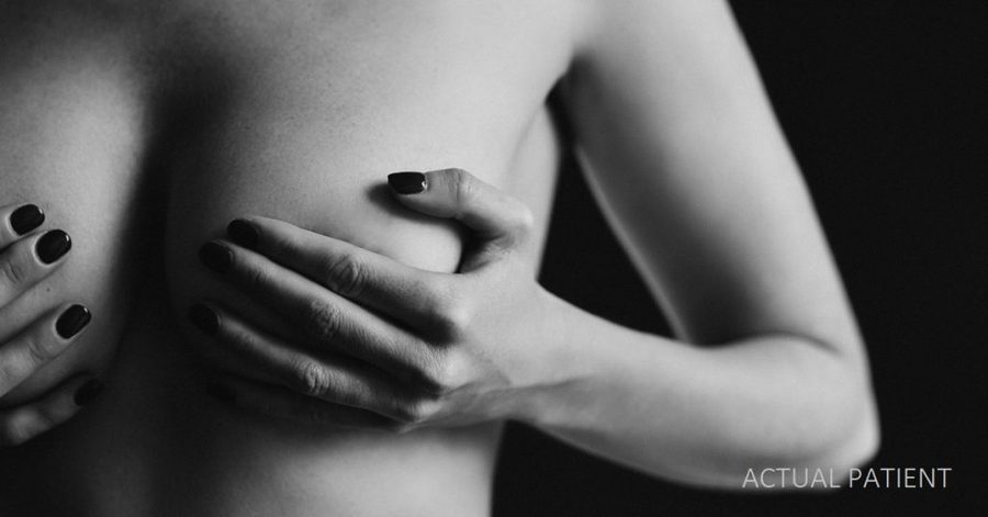 Breast Surgeon Explains 3 Most Common Issues After Implants | Austin