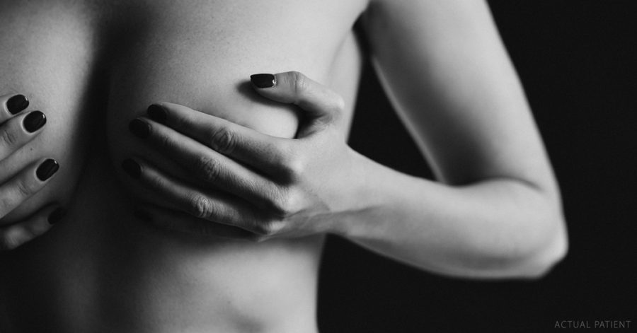 Slimplants: The Modern Breast Implant Explained