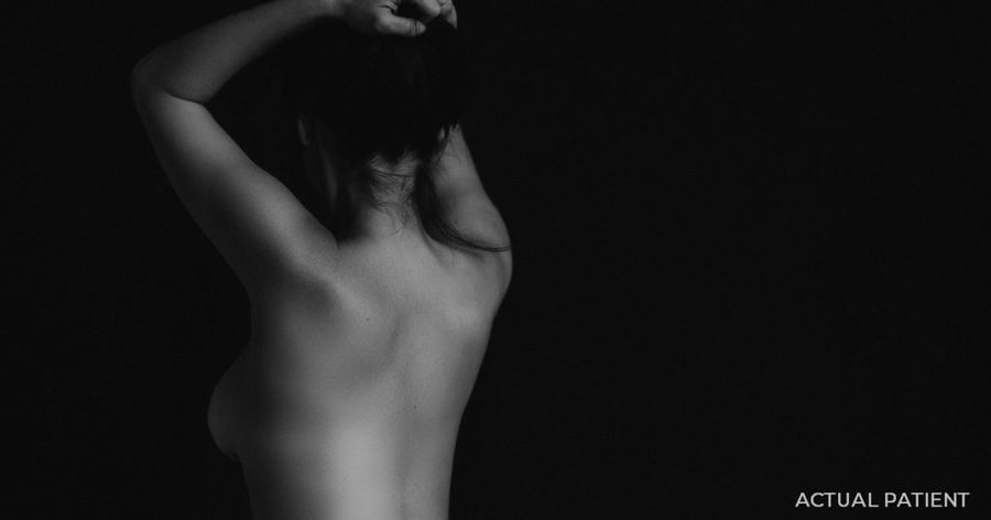 Managing Swelling After Plastic Surgery in Austin | Dr. Rocco Piazza