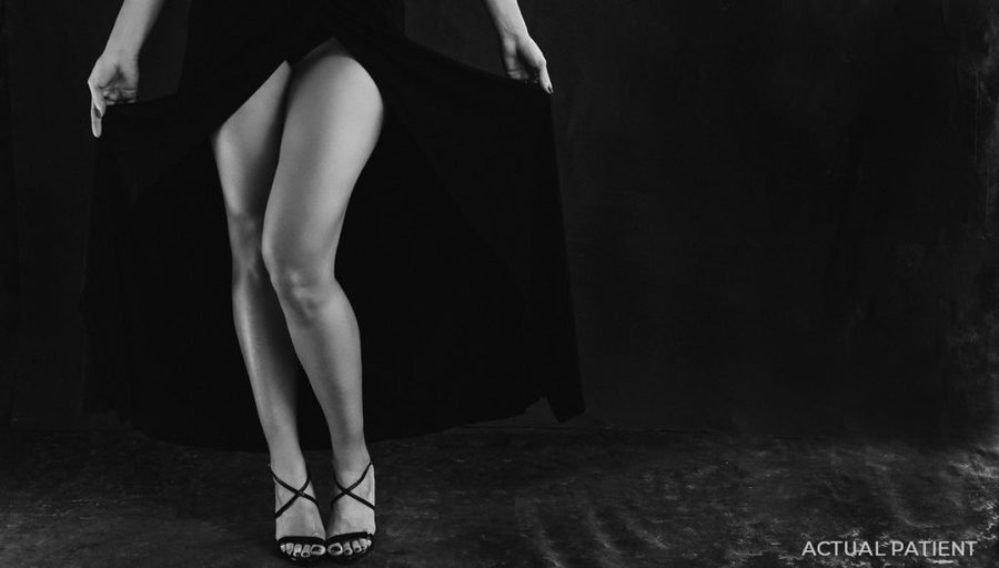Our Top 5 Reasons for Correcting Your Cellulite with Profound RF Microneedling | Piazza Center for Plastic Surgery and Advanced Skin Care