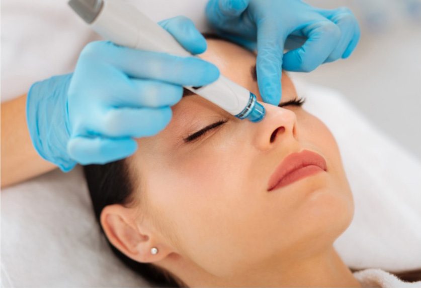 Patient receiving a clear skin acne treatment at The Piazza Center
