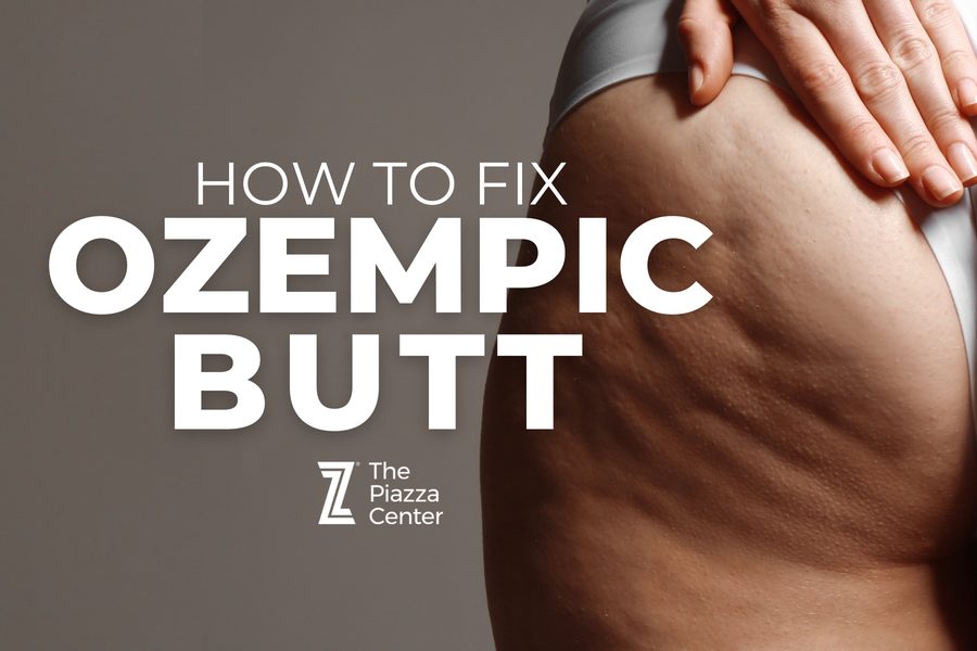 Ozempic Butt: How to Fix Volume Loss, Sagging & Cellulite