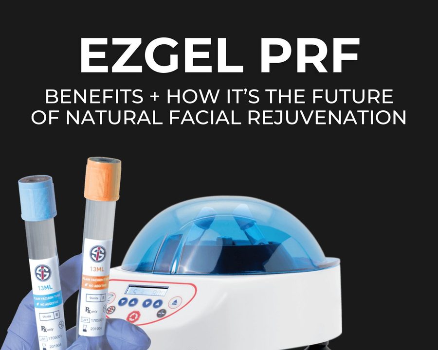 what is ezGEL + Results