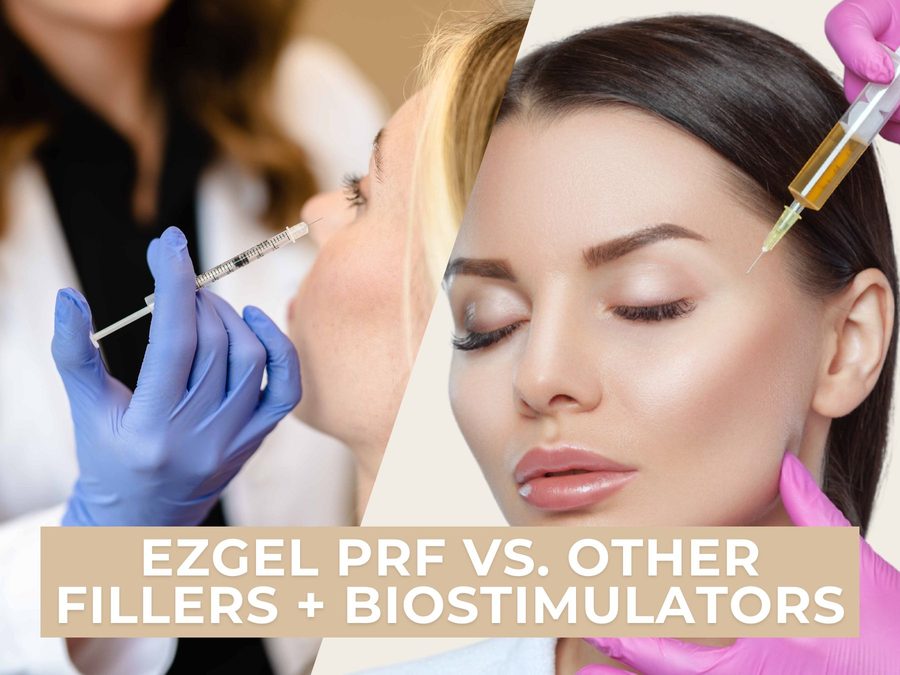 EZGel PRF vs. Other Fillers and Biostimulators: Unveiling the Right Choice for You