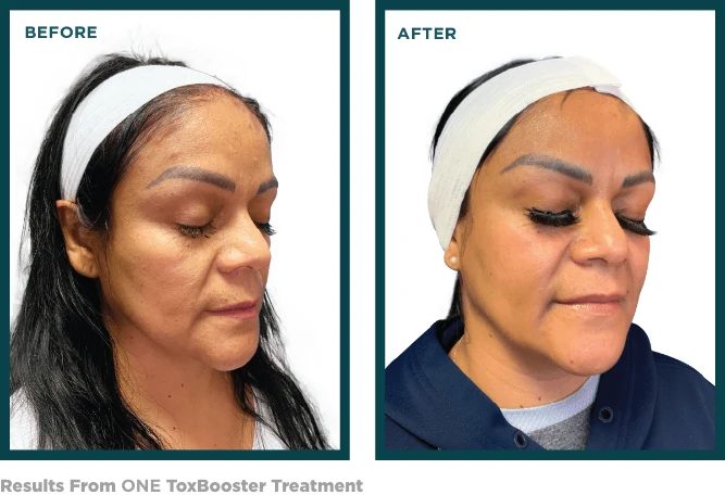 ToxBooster Treatment Results ToxBooster Results
