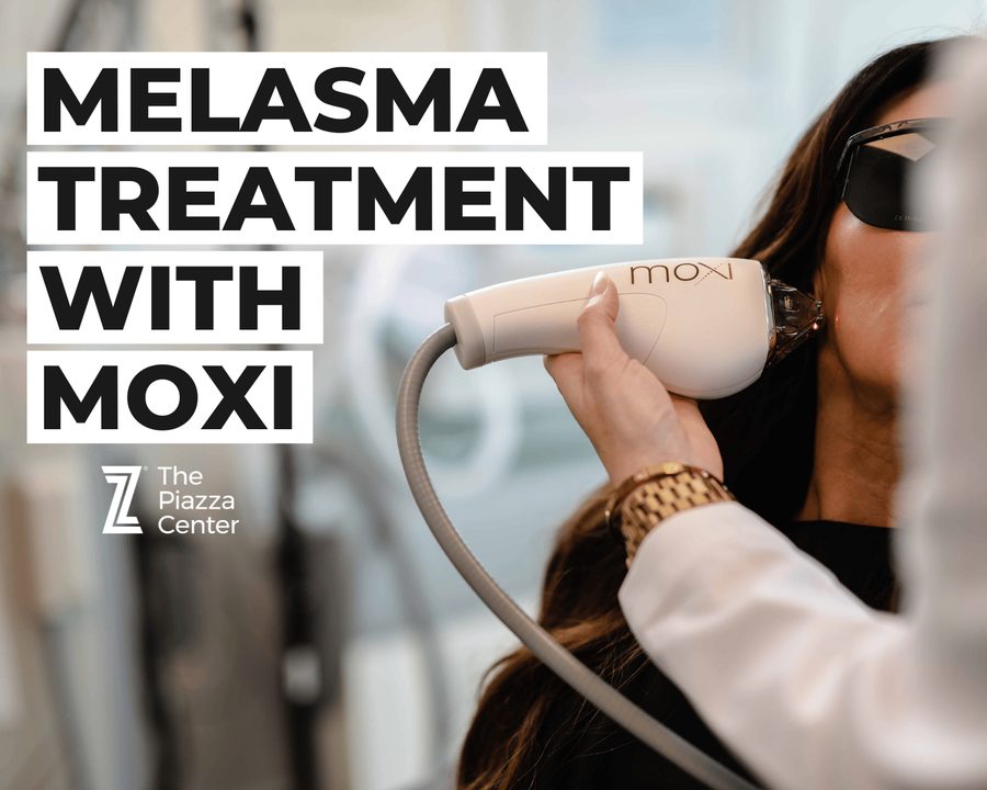 Moxi Laser to treat Melasma