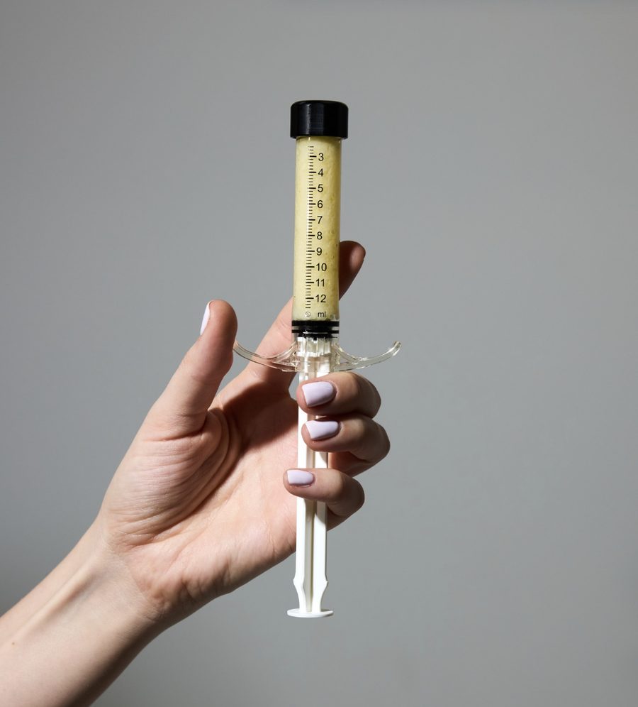 Why AlloClae Is the Future of Fat Grafting | AlloClae Fat Transfer in Austin