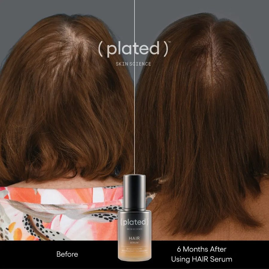 Plated Hair Before and After from GLP-1 Hair Loss