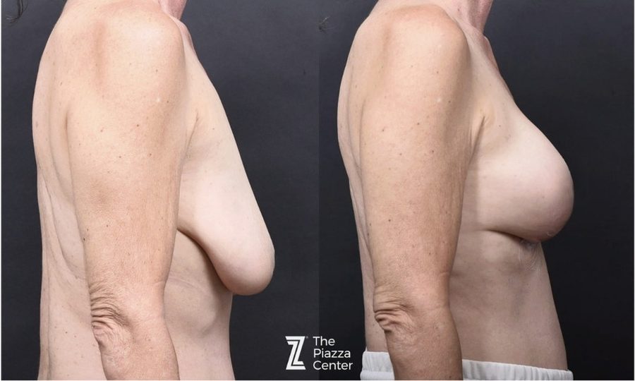 Motiva Preservé Before and After